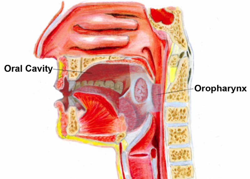 oropharyngeal cancer